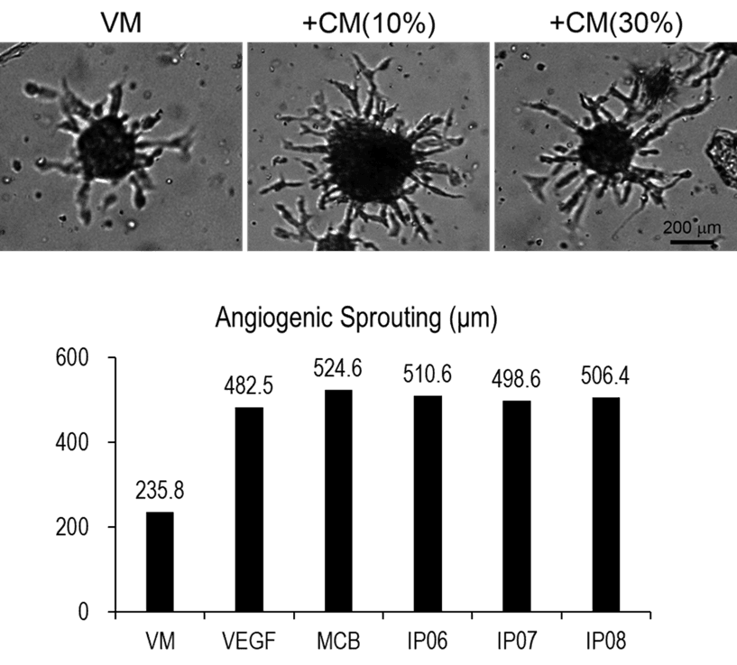 Angiogenesis image 2